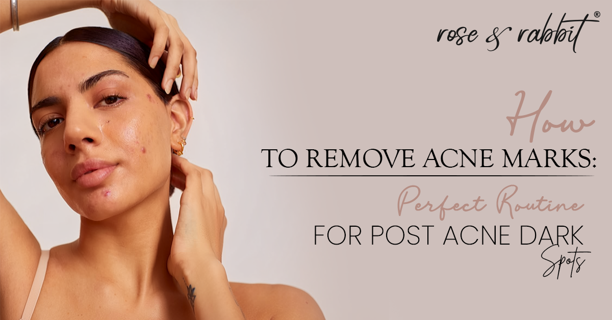 How to Remove Acne Marks: Perfect Routine for Post Acne Dark Spots