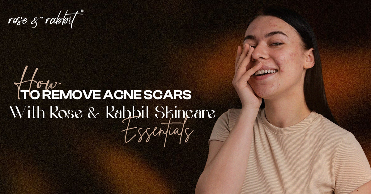 How to Remove Acne Scars With Rose & Rabbit Skincare Essentials?