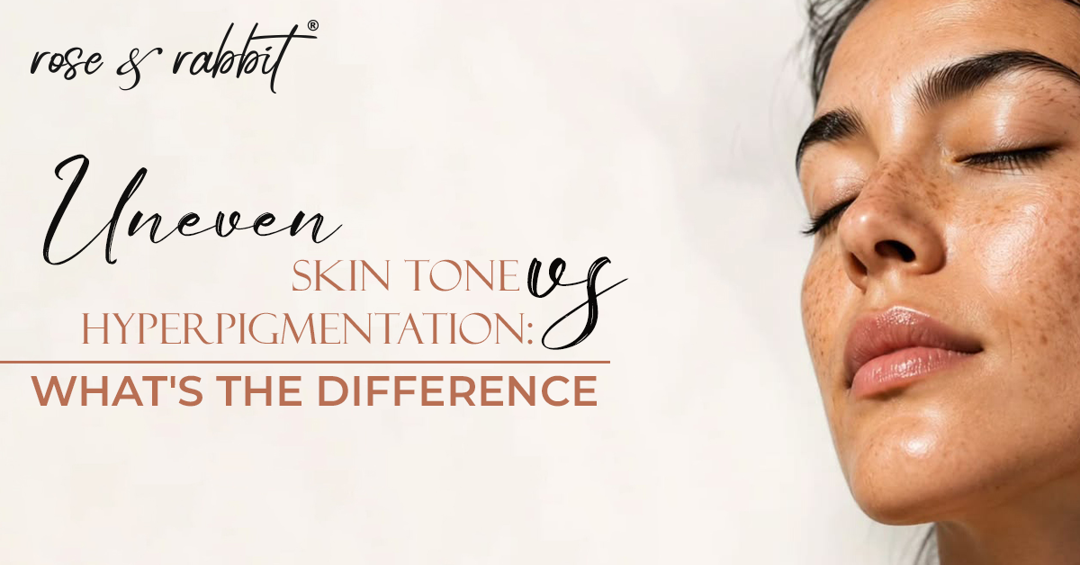 Uneven Skin Tone vs Hyperpigmentation: What's the Difference